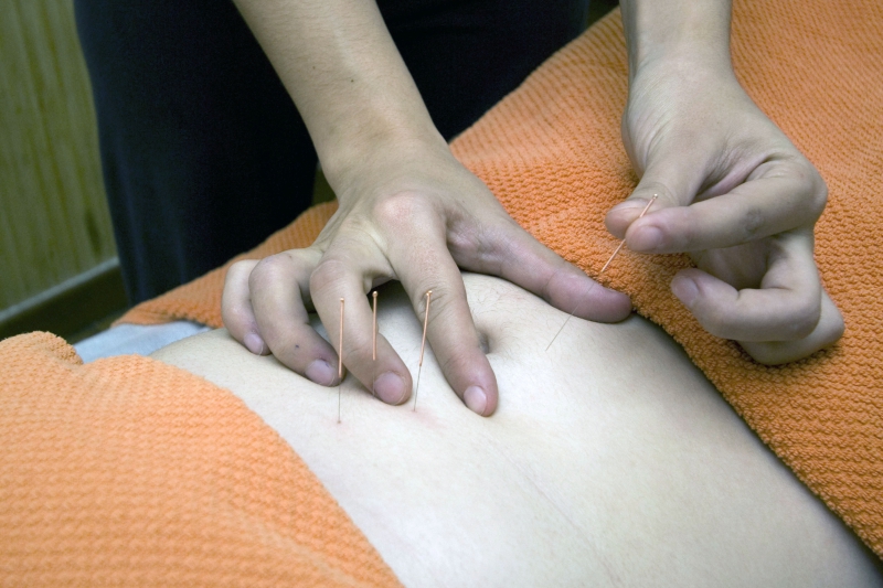 osteopathe-CARQUEIRANNE-min_acupuncture-4175625